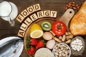 4 Reasons To Be Food Allergy Aware KSB Hospitality and Catering Recruitment Agency